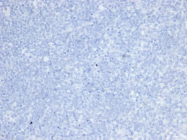 HER-2/c-erbB-2/neu/CD340 Antibody in Immunohistochemistry (Paraffin) (IHC (P))