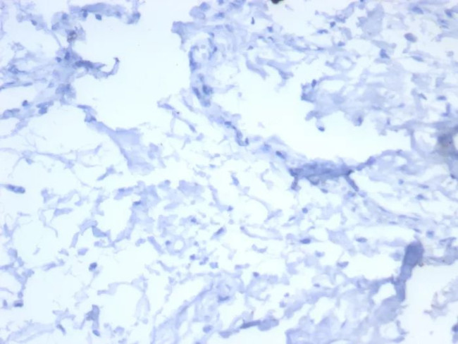 HER-2/c-erbB-2/neu/CD340 Antibody in Immunohistochemistry (Paraffin) (IHC (P))