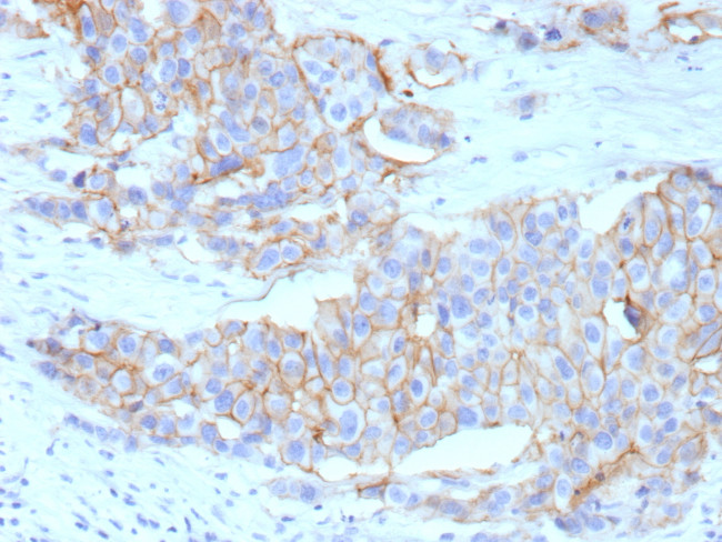 HER-2/c-erbB-2/neu/CD340 Antibody in Immunohistochemistry (Paraffin) (IHC (P))