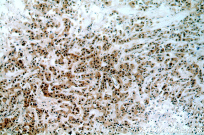 BRCA1 Antibody in Immunohistochemistry (Paraffin) (IHC (P))