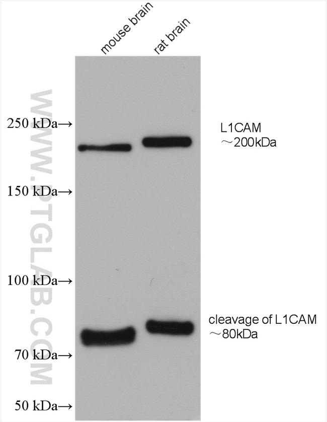 L1CAM Antibody in Western Blot (WB)