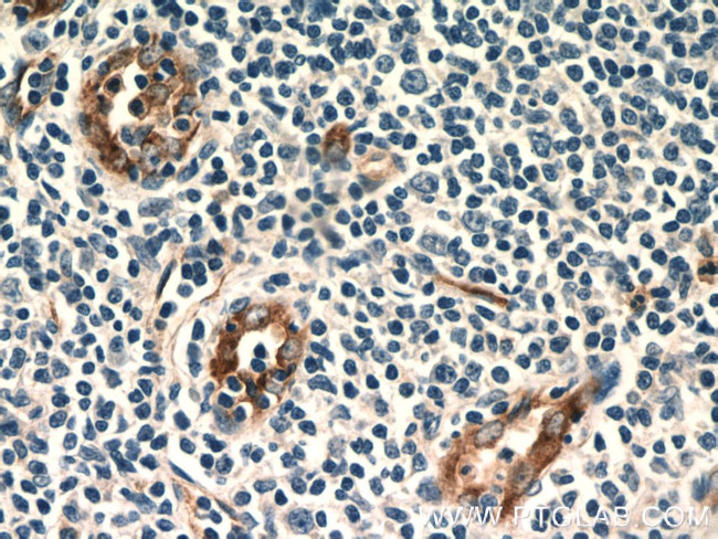 Stabilin-1 Antibody in Immunohistochemistry (Paraffin) (IHC (P))