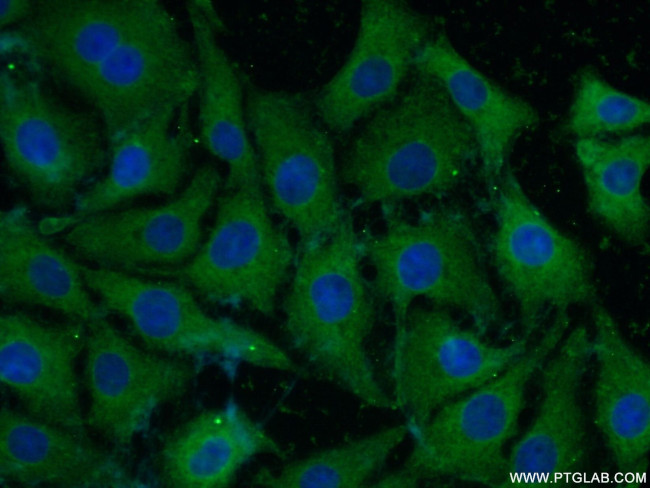 NF-M Antibody in Immunocytochemistry (ICC/IF)