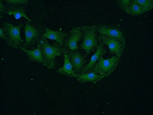 CaMKII alpha Antibody in Immunocytochemistry (ICC/IF)