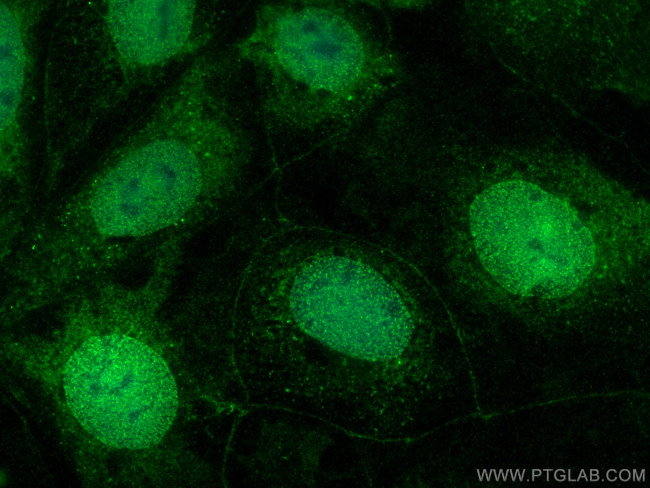Synaptotagmin-8 Antibody in Immunocytochemistry (ICC/IF)