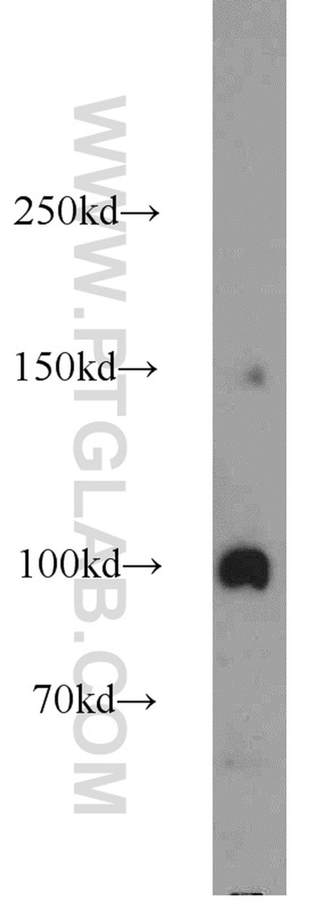 Transportin-1 Antibody in Western Blot (WB)