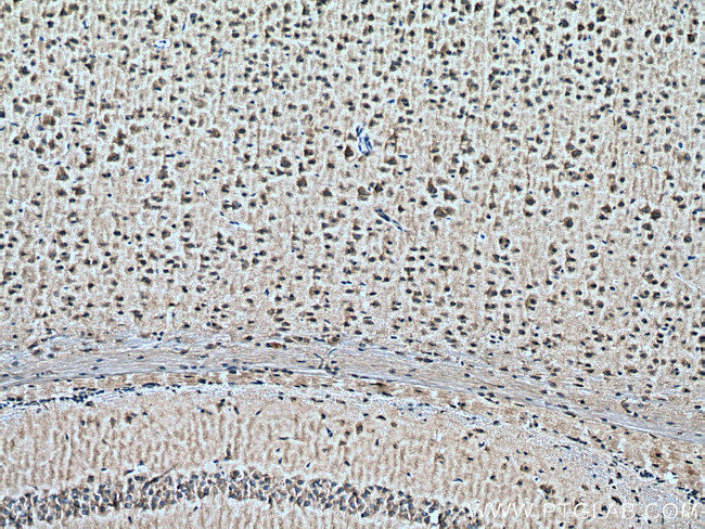 DOCK3/MOCA Antibody in Immunohistochemistry (Paraffin) (IHC (P))