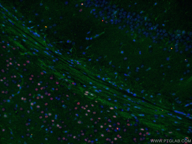 RELN Antibody in Immunohistochemistry (Paraffin) (IHC (P))
