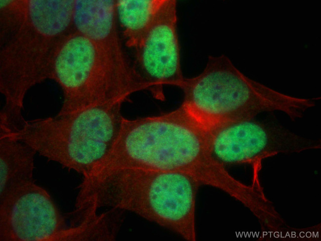 ER Antibody in Immunocytochemistry (ICC/IF)