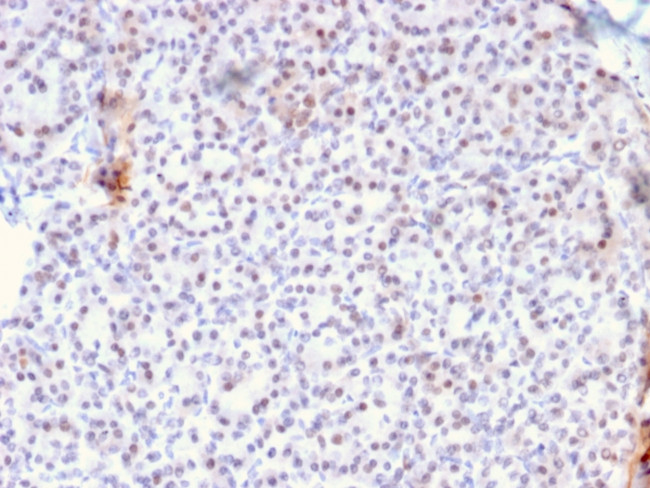 AKT1 Antibody in Immunohistochemistry (Paraffin) (IHC (P))