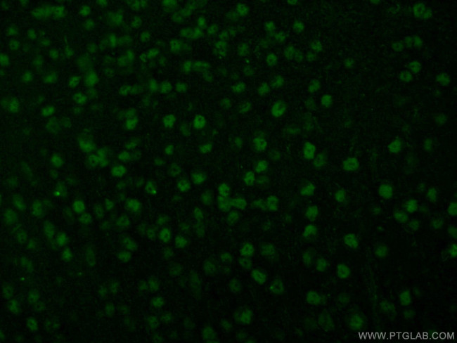 RUNX2 Antibody in Immunohistochemistry (Paraffin) (IHC (P))