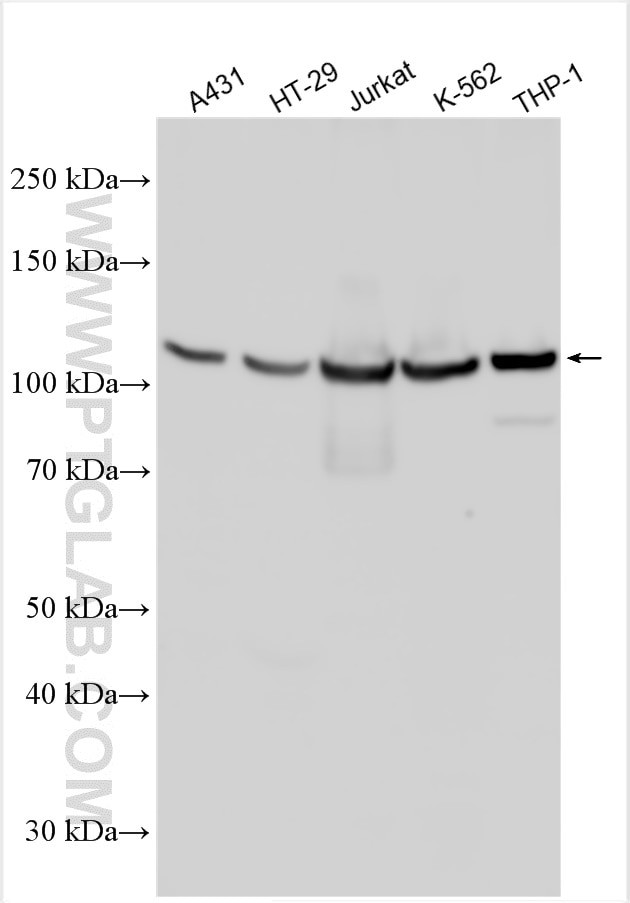 ABCB5 Antibody in Western Blot (WB)