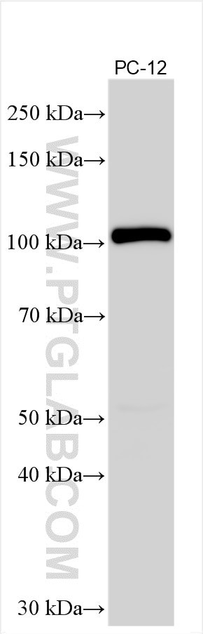 CTNND2 Antibody in Western Blot (WB)