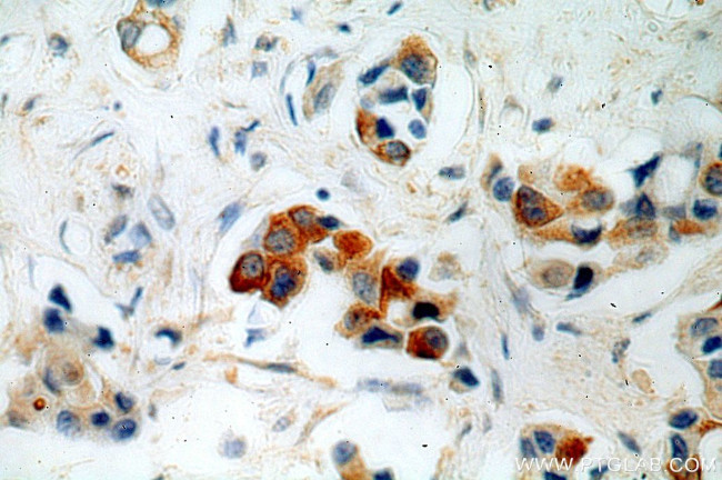 FGF8 Antibody in Immunohistochemistry (Paraffin) (IHC (P))