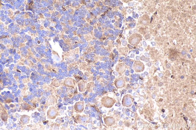 PRKD1 Antibody in Immunohistochemistry (Paraffin) (IHC (P))