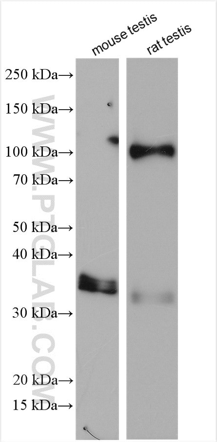 ESPN Antibody in Western Blot (WB)