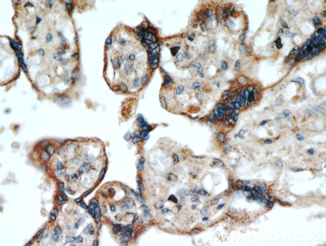 TMC1 Antibody in Immunohistochemistry (Paraffin) (IHC (P))