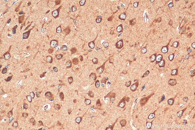 OTOF Antibody in Immunohistochemistry (Paraffin) (IHC (P))