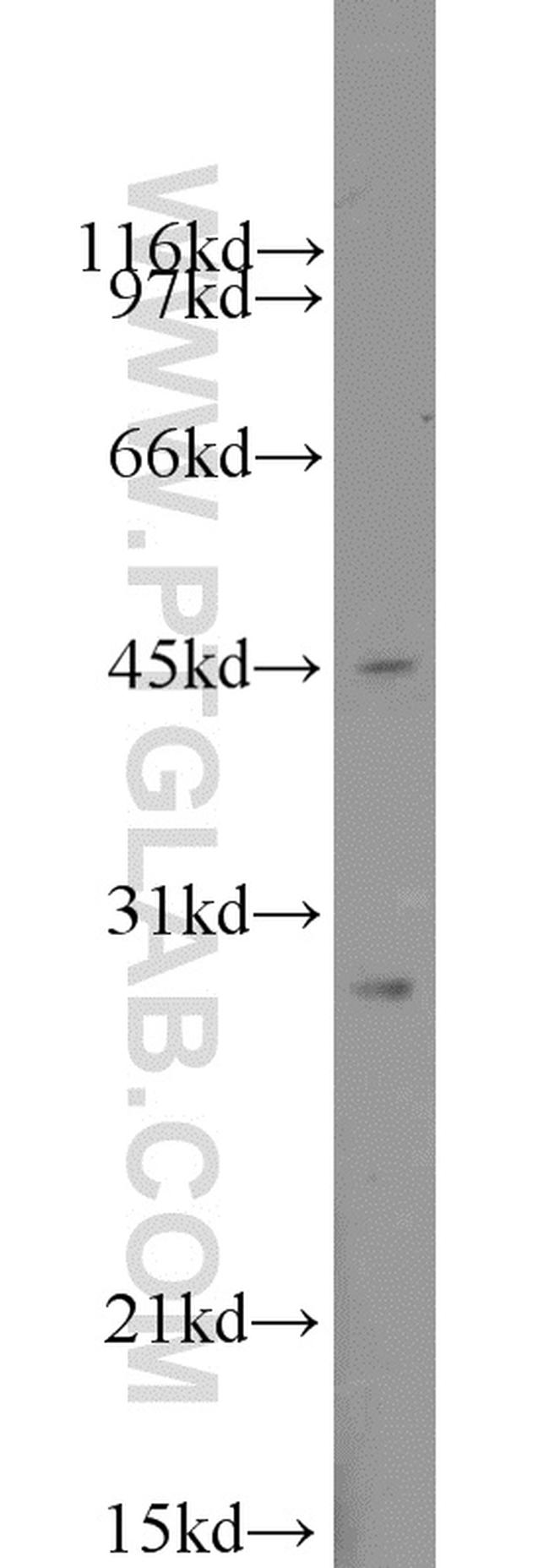 Claudin 22 Antibody in Western Blot (WB)