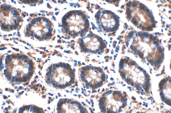 MUC5AC Antibody in Immunohistochemistry (Paraffin) (IHC (P))
