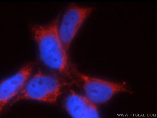 GNRHR2 Antibody in Immunocytochemistry (ICC/IF)