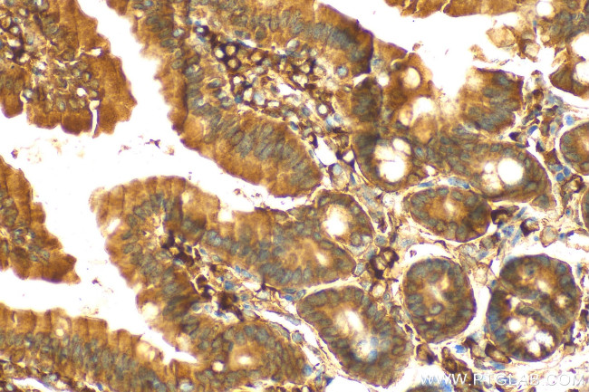 ITPR3 Antibody in Immunohistochemistry (Paraffin) (IHC (P))