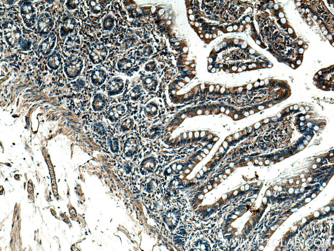 ITPR2 Antibody in Immunohistochemistry (Paraffin) (IHC (P))