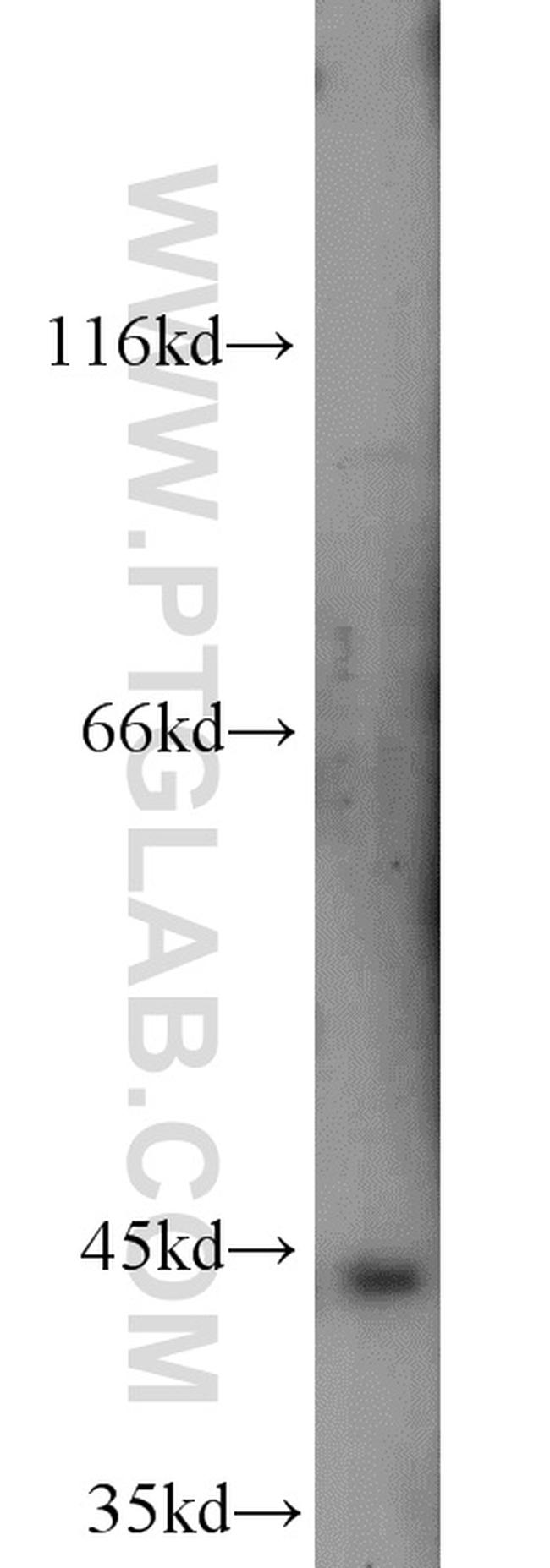 Brachyury-T Antibody in Western Blot (WB)