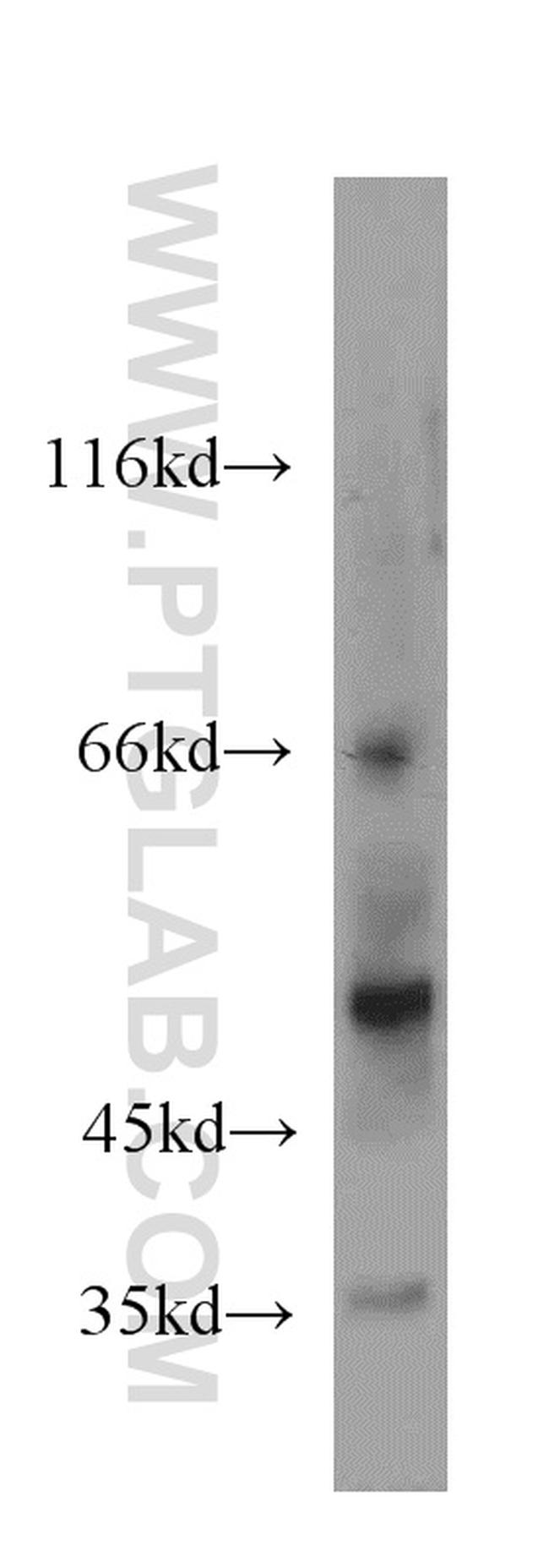 NPT1 Antibody in Western Blot (WB)
