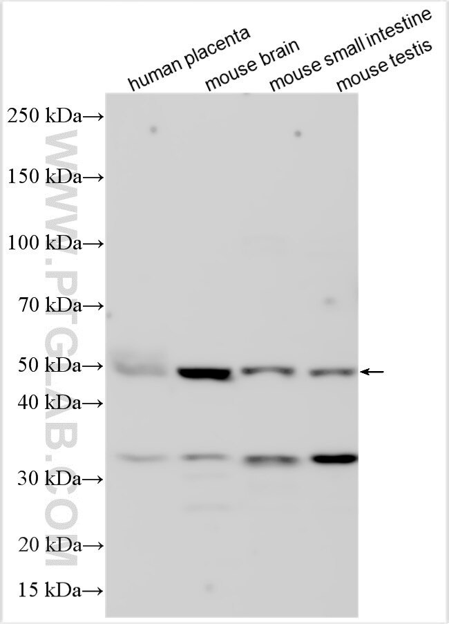 TRAPPC5 Antibody in Western Blot (WB)