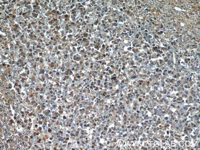 IgG light chain (lambda) Antibody in Immunohistochemistry (Paraffin) (IHC (P))