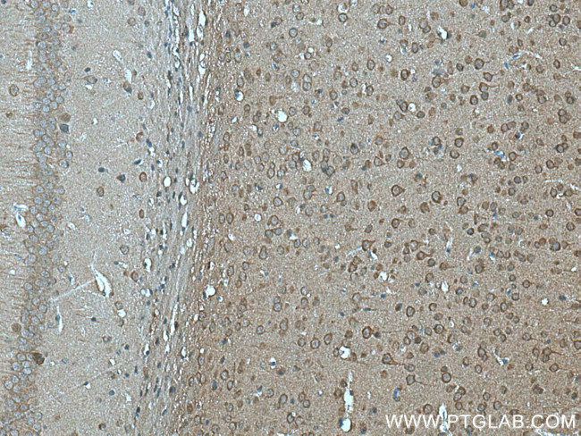 FAM57B Antibody in Immunohistochemistry (Paraffin) (IHC (P))