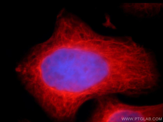 CAPRIN2 Antibody in Immunocytochemistry (ICC/IF)