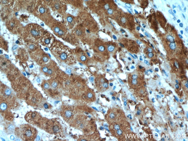 TRMT2B Antibody in Immunohistochemistry (Paraffin) (IHC (P))