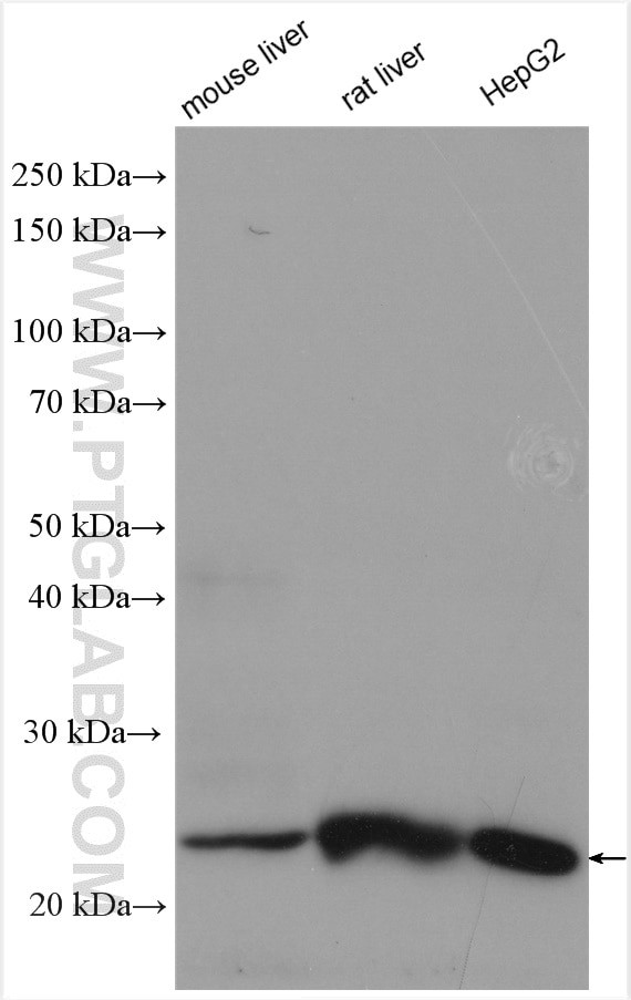 TMEM41A Antibody in Western Blot (WB)