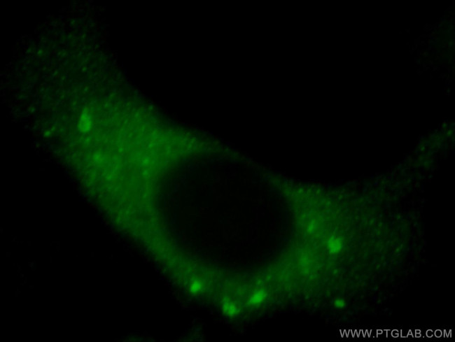 VIPAS39 Antibody in Immunocytochemistry (ICC/IF)