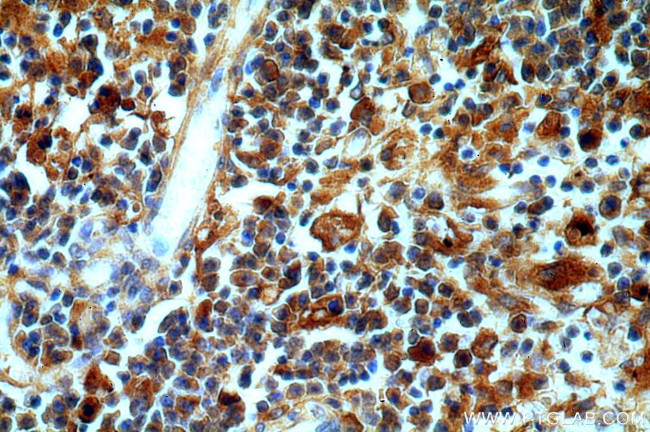 Serum amyloid P component Antibody in Immunohistochemistry (Paraffin) (IHC (P))