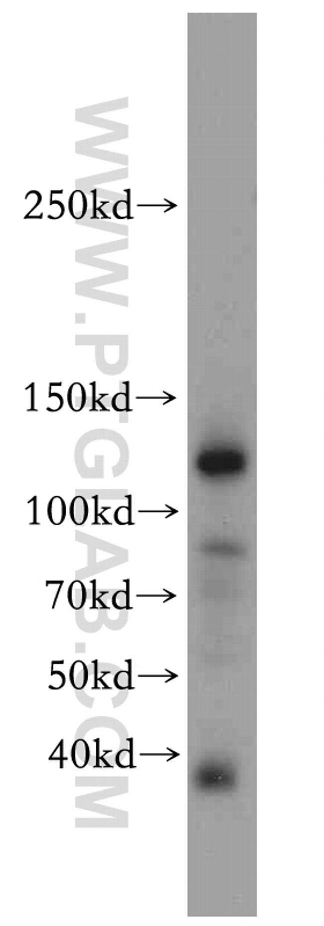 CC2D1B Antibody in Western Blot (WB)