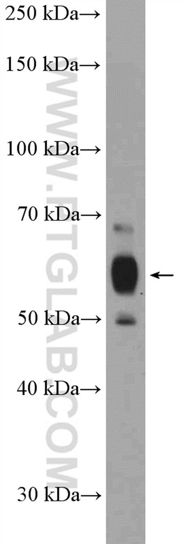C8orf41 Antibody in Western Blot (WB)