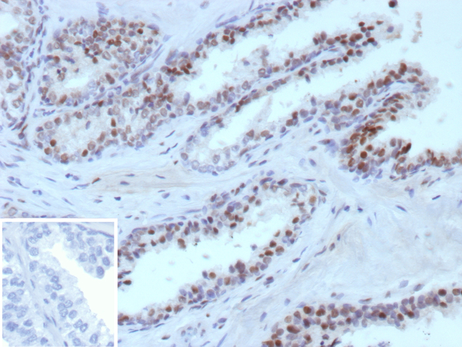 ERG/ETS Transcription Factor (Prostate Cancer Marker) Antibody in Immunohistochemistry (Paraffin) (IHC (P))