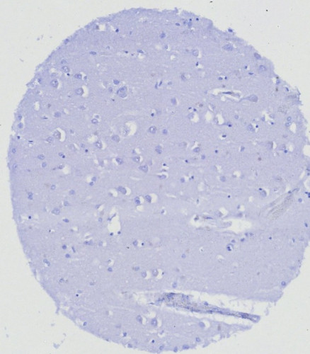 ERG (Vascular Endothelial and Prostate Marker) Antibody in Immunohistochemistry (Paraffin) (IHC (P))