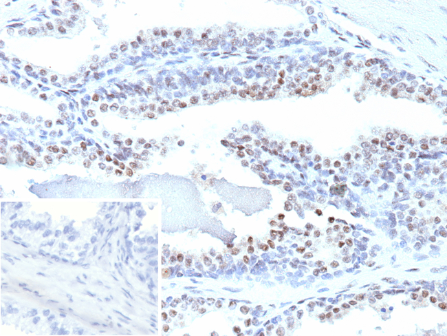 ERG/ETS Transcription Factor (Prostate Cancer Marker) Antibody in Immunohistochemistry (Paraffin) (IHC (P))