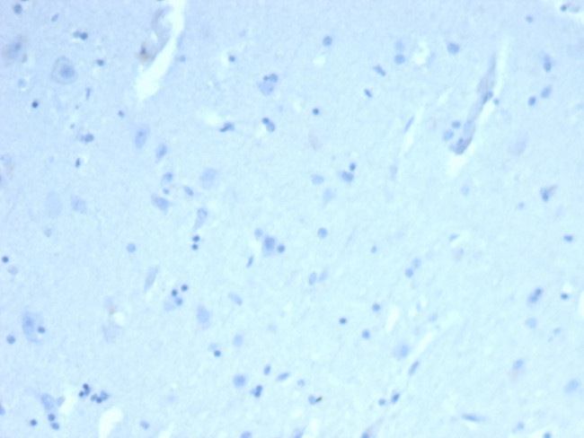 ERG Antibody in Immunohistochemistry (Paraffin) (IHC (P))