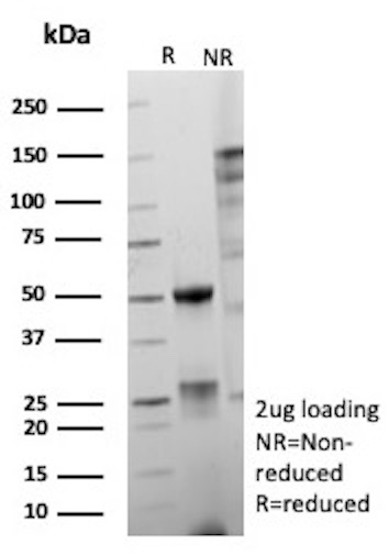 ERG/ETS Transcription Factor (Prostate Cancer Marker) Antibody in SDS-PAGE (SDS-PAGE)