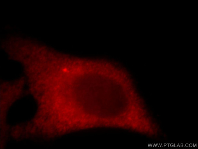C11orf70 Antibody in Immunocytochemistry (ICC/IF)