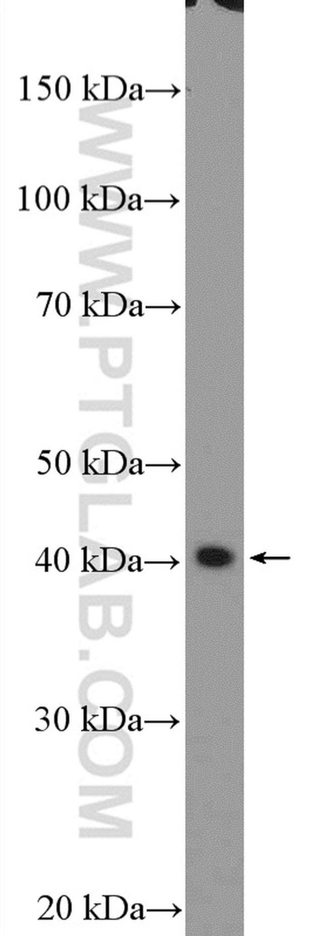 PDCD2L Antibody in Western Blot (WB)