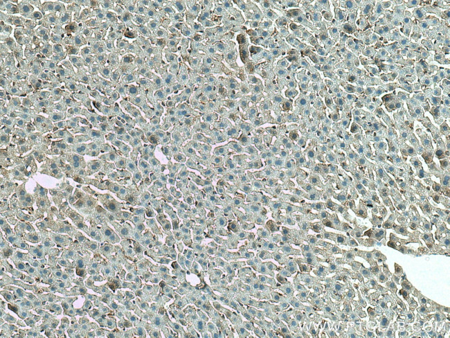 ANO6 Antibody in Immunohistochemistry (Paraffin) (IHC (P))
