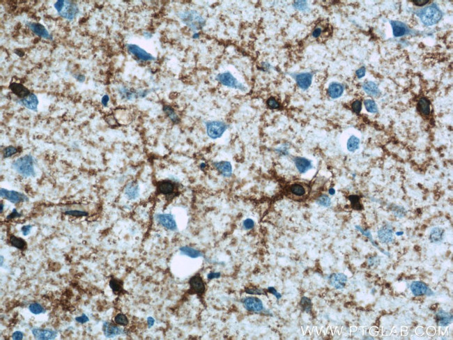 GLAST Antibody in Immunohistochemistry (Paraffin) (IHC (P))