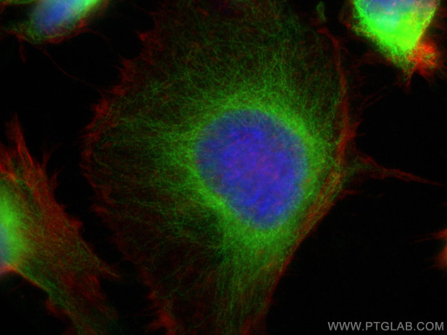 MAP7D1 Antibody in Immunocytochemistry (ICC/IF)