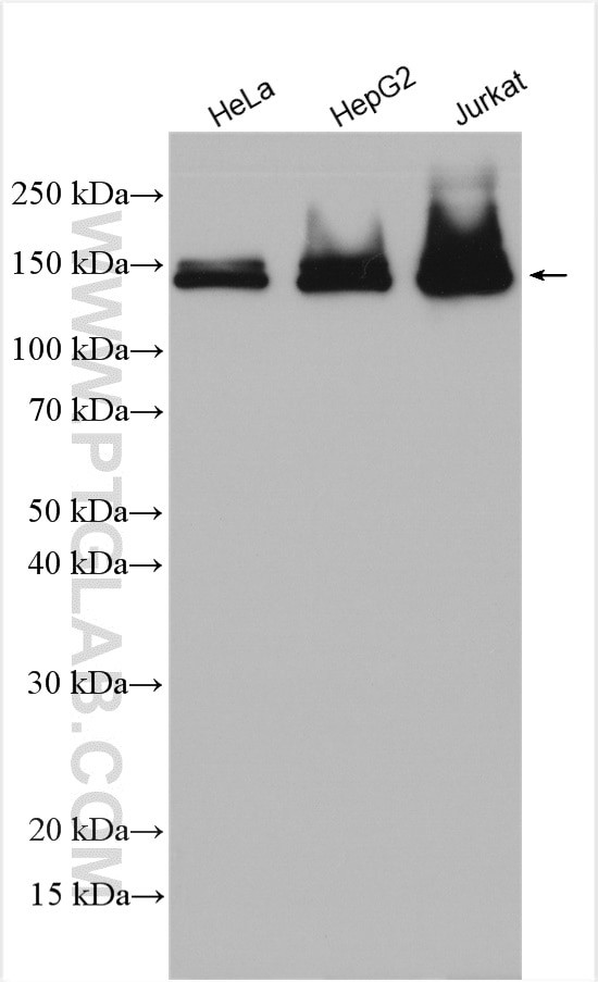 FANCI Antibody in Western Blot (WB)